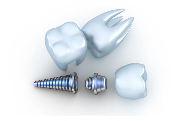 titanium tooth implant stock