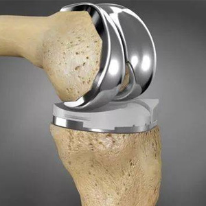 custom titanium artificial joints stock